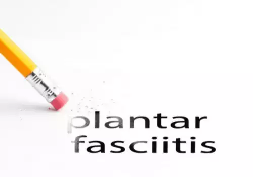 Read more about the article PLANTAR FASCIITIS